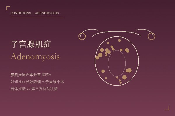子宫腺肌症